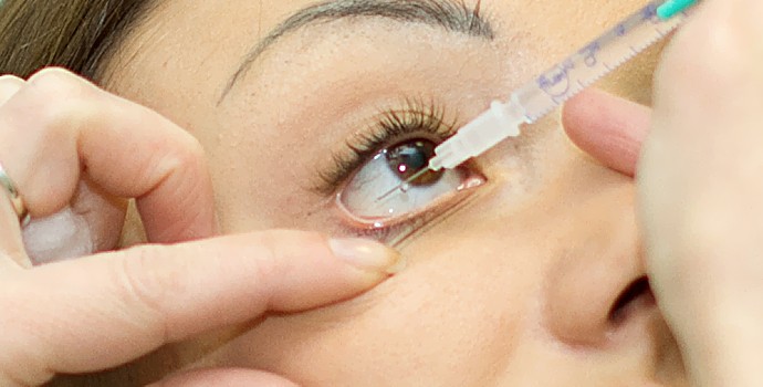 Devez-vous accepter les injections d’Avastin dans vos yeux ?